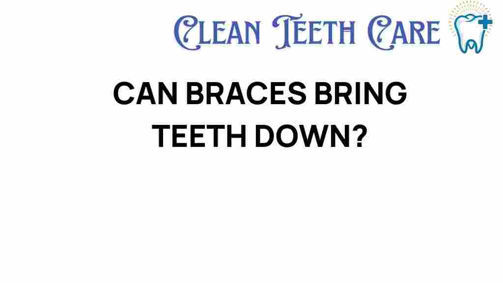 braces-bring-teeth-down