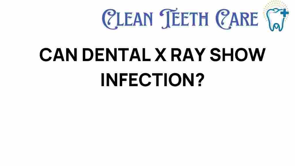 dental-x-ray-show-infection