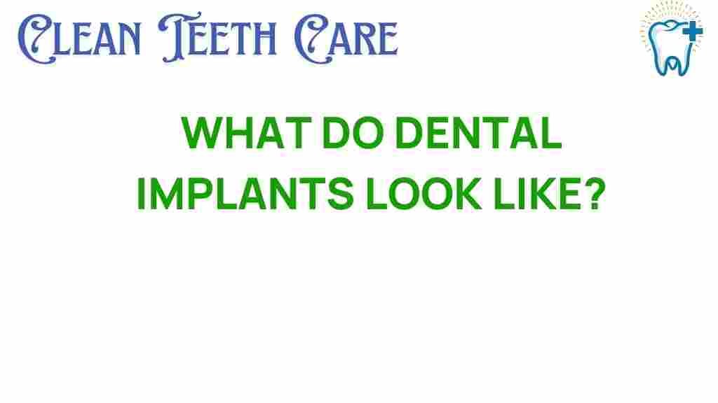 dental-implants-look-like