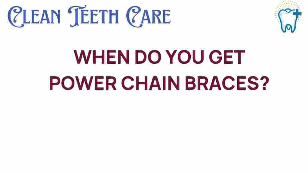 power-chain-braces-timing