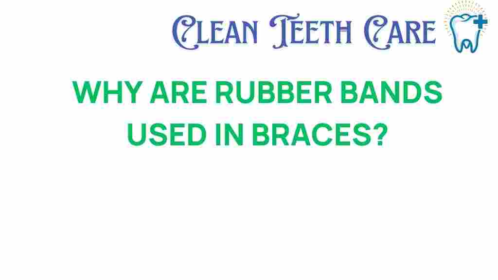 rubber-bands-used-in-braces