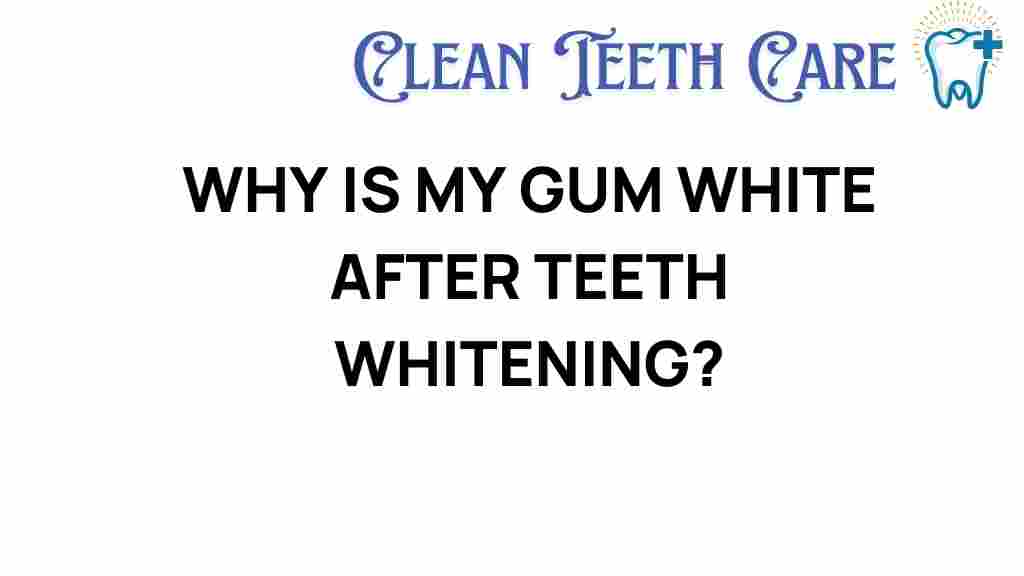 white-gums-teeth-whitening